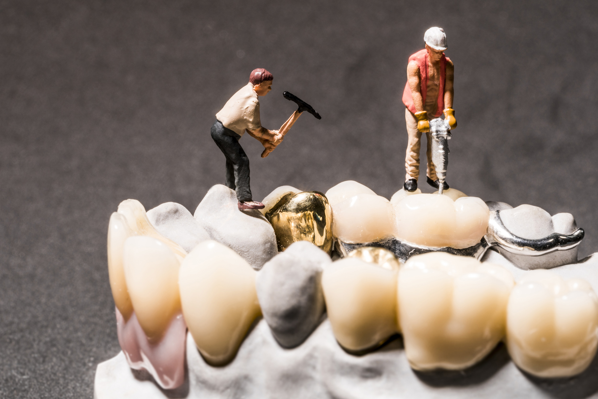 Welche Füllung ist die beste? – Praxis für Zahnmedizin